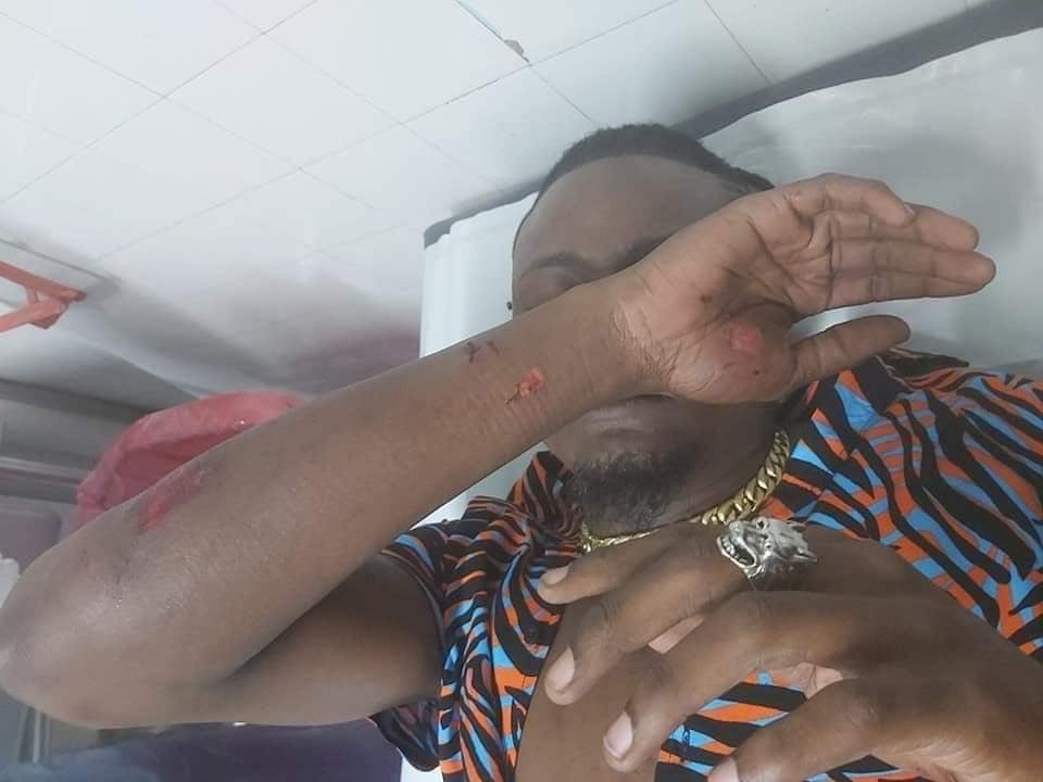 Pallaso attacked  in South African