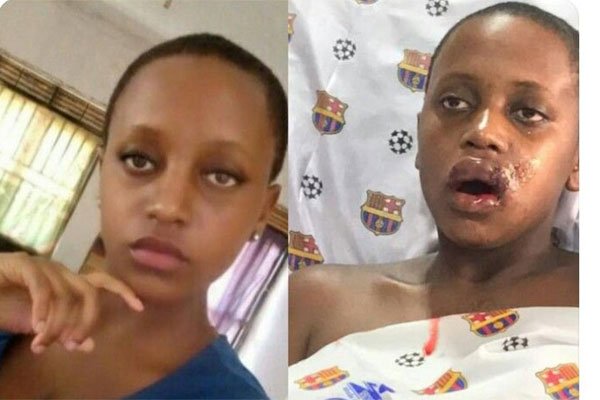 Family of injured student demands Shs1 billion from KCCA