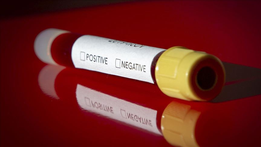 Ugandan baby diagnosed with coronavirus