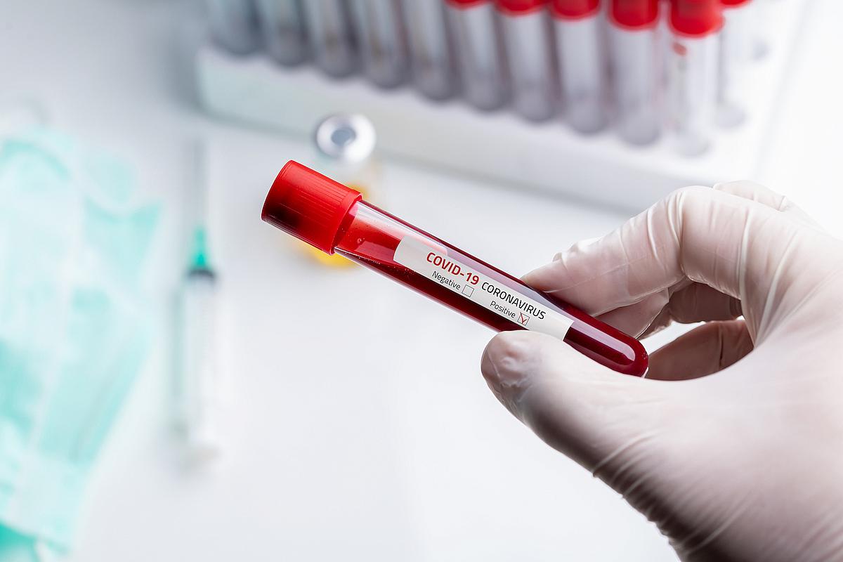 8 COVID-19 patients discharged as Uganda’s virus recoveries rise to 20