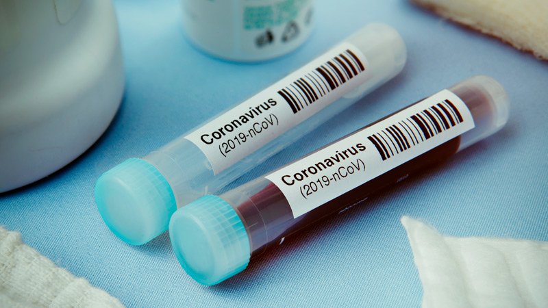 COVID-19 cases in Uganda rise to 63