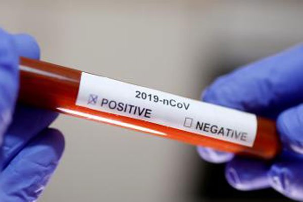 Number of coronavirus cases in Uganda hit 48