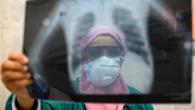 Coronavirus: Egypt doctors accuse government over medics’ deaths