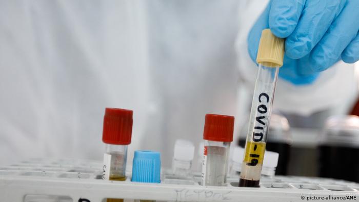 Kenya looks for 400 coronavirus vaccine volunteers
